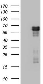 RIPK3 Antibody in Western Blot (WB)