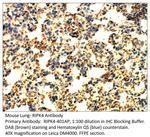 RIPK4 Antibody in Immunohistochemistry (IHC)