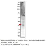 CRALBP Polyclonal Antibody