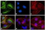 Mouse IgG1 Secondary Antibody in Immunocytochemistry (ICC/IF)