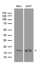 RMI2 Antibody in Western Blot (WB)