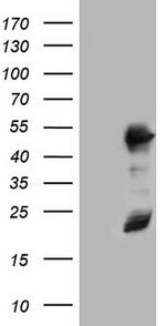 RMND5A Antibody in Western Blot (WB)
