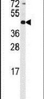 RMND5B Antibody in Western Blot (WB)