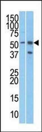 URI1 Antibody in Western Blot (WB)