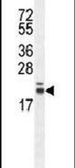 RNF185 Antibody in Western Blot (WB)