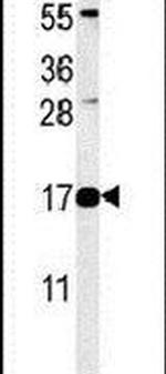 RNaseK Antibody in Western Blot (WB)