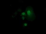 RND1 Antibody in Immunocytochemistry (ICC/IF)