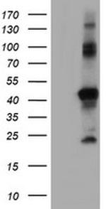 RNF113B Antibody in Western Blot (WB)