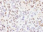 RNF138 Antibody in Immunohistochemistry (IHC)