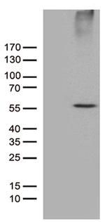 RNF14 Antibody in Western Blot (WB)