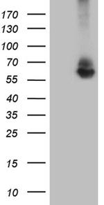 RNF149 Antibody in Western Blot (WB)
