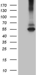 RNF149 Antibody in Western Blot (WB)