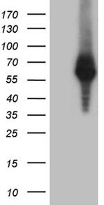 RNF149 Antibody in Western Blot (WB)
