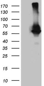RNF149 Antibody in Western Blot (WB)