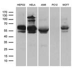 RNF149 Antibody in Western Blot (WB)