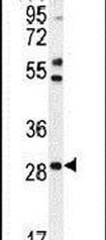 RNF183 Antibody in Western Blot (WB)