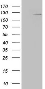RNF20 Antibody in Western Blot (WB)