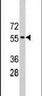 RNF36 Antibody in Western Blot (WB)