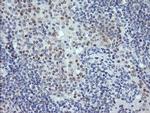 RNF39 Antibody in Immunohistochemistry (Paraffin) (IHC (P))