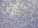 RNF39 Antibody in Immunohistochemistry (Paraffin) (IHC (P))