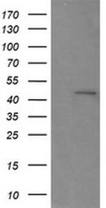 RNF39 Antibody in Western Blot (WB)
