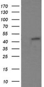 RNF39 Antibody in Western Blot (WB)