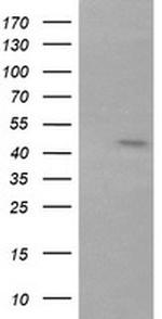RNF39 Antibody in Western Blot (WB)