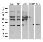 RNF4 Antibody in Western Blot (WB)