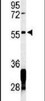 RNF8 Antibody in Western Blot (WB)