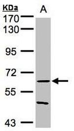 RNF8 Antibody in Western Blot (WB)