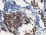 RNH1 Antibody in Immunohistochemistry (Paraffin) (IHC (P))