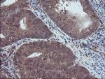 RNH1 Antibody in Immunohistochemistry (Paraffin) (IHC (P))