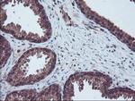 RNH1 Antibody in Immunohistochemistry (Paraffin) (IHC (P))