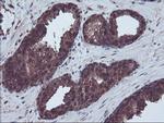 RNH1 Antibody in Immunohistochemistry (Paraffin) (IHC (P))