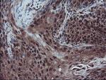RNH1 Antibody in Immunohistochemistry (Paraffin) (IHC (P))