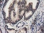 RNH1 Antibody in Immunohistochemistry (Paraffin) (IHC (P))