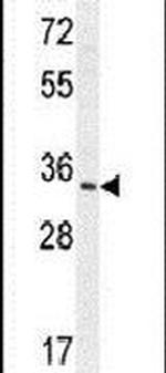 RNASET2 Antibody in Western Blot (WB)