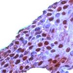 ROC1 Antibody in Immunohistochemistry (IHC)