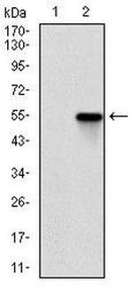 ROCK1 Monoclonal Antibody (1H4)