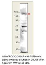 ROCK2 Polyclonal Antibody