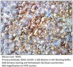 ROR1 Antibody in Immunohistochemistry (IHC)