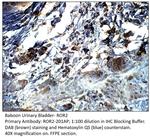 ROR2 Polyclonal Antibody