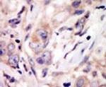 ROR2 Antibody in Immunohistochemistry (IHC)