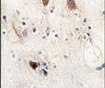 ROR2 Antibody in Immunohistochemistry (IHC)