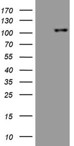 ROR2 Antibody in Western Blot (WB)