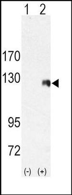 ROR2 Antibody in Western Blot (WB)