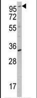 ROR2 Antibody in Western Blot (WB)