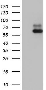 RORA Antibody in Western Blot (WB)