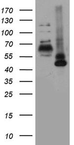 RORA Antibody in Western Blot (WB)
