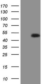 RORB Antibody in Western Blot (WB)